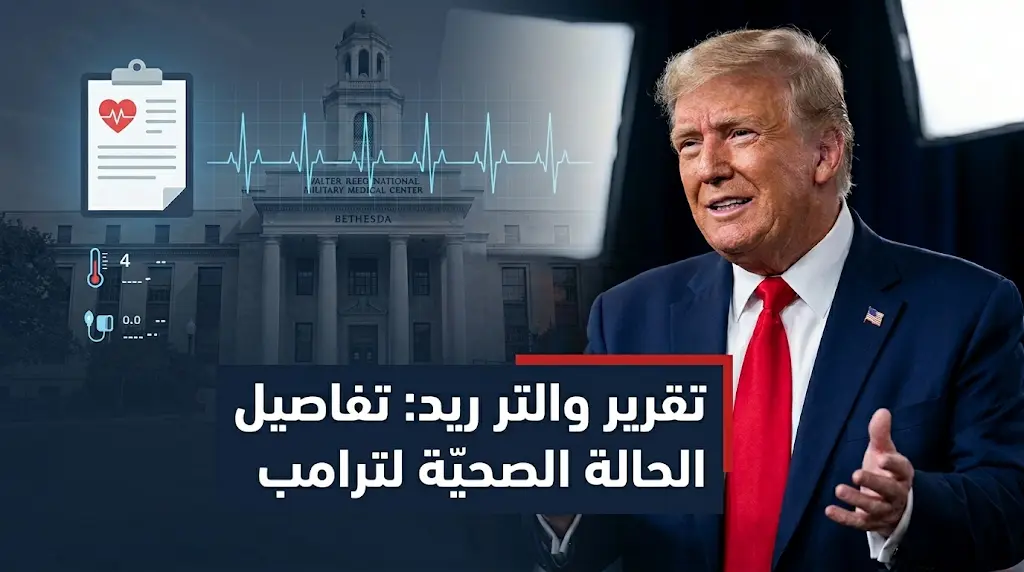 تقرير طبي يكشف نتائج فحوصات ترامب في والتر ريد ويوضح سبب ظهور كدمات على يديه
