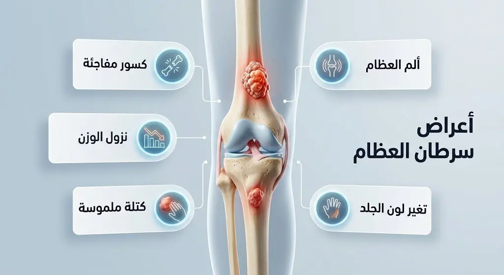إنفوجرافيك طبي يوضح الأعراض الشائعة لسرطان العظام مثل ألم المفاصل، الكسور المفاجئة، ونزول الوزن.