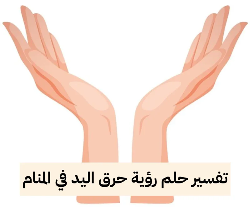 تفسير حلم رؤية حرق اليد في المنام