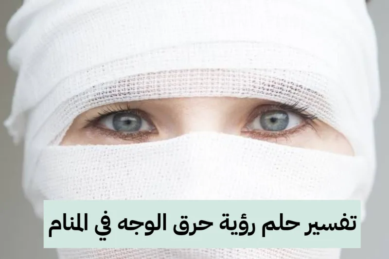 تفسير حلم رؤية حرق الوجه في المنام