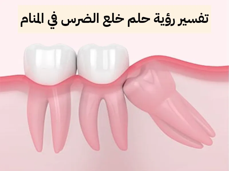 تفسير رؤية حلم خلع الضرس في المنام بالتفصيل .. 7 تفسيرات مختلفة لخلع الضرس في الحلم