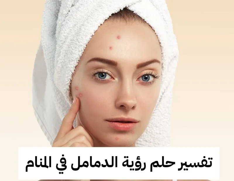 تفسير حلم رؤية الدمامل في المنام