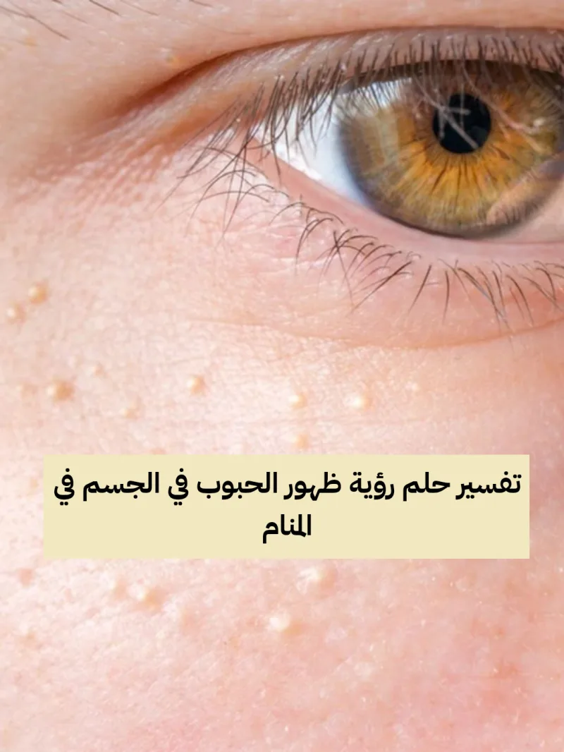 تفسير حلم رؤية ظهور الحبوب في الجسم في المنام