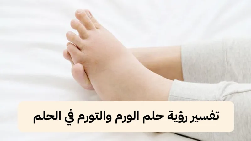 تفسير رؤية حلم الورم والتورم في الحلم