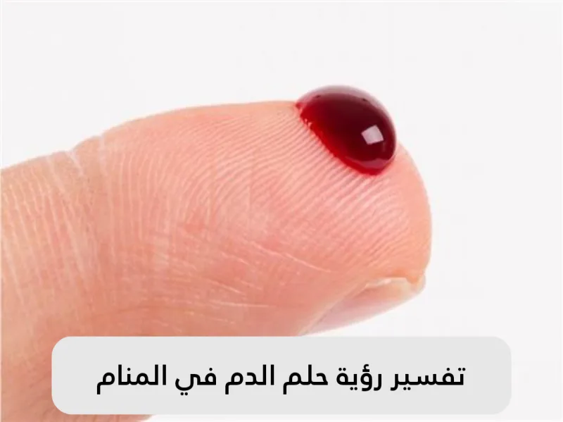 تفسير رؤية حلم الدم في المنام